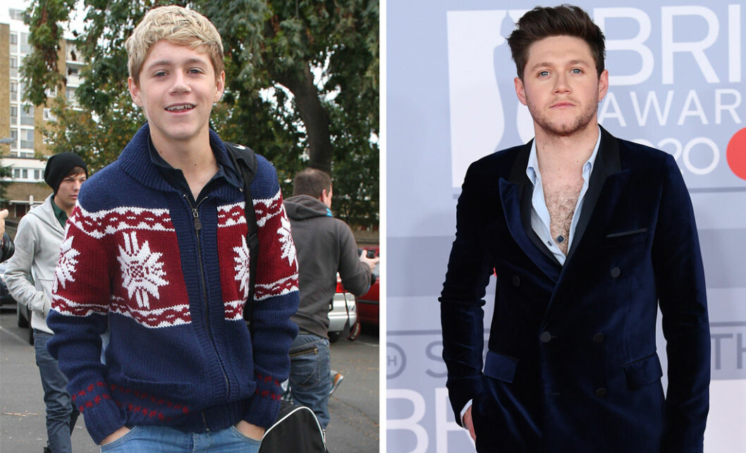 Niall Horan 2010 vs i dag. Niall Horan 2010 och 2020
