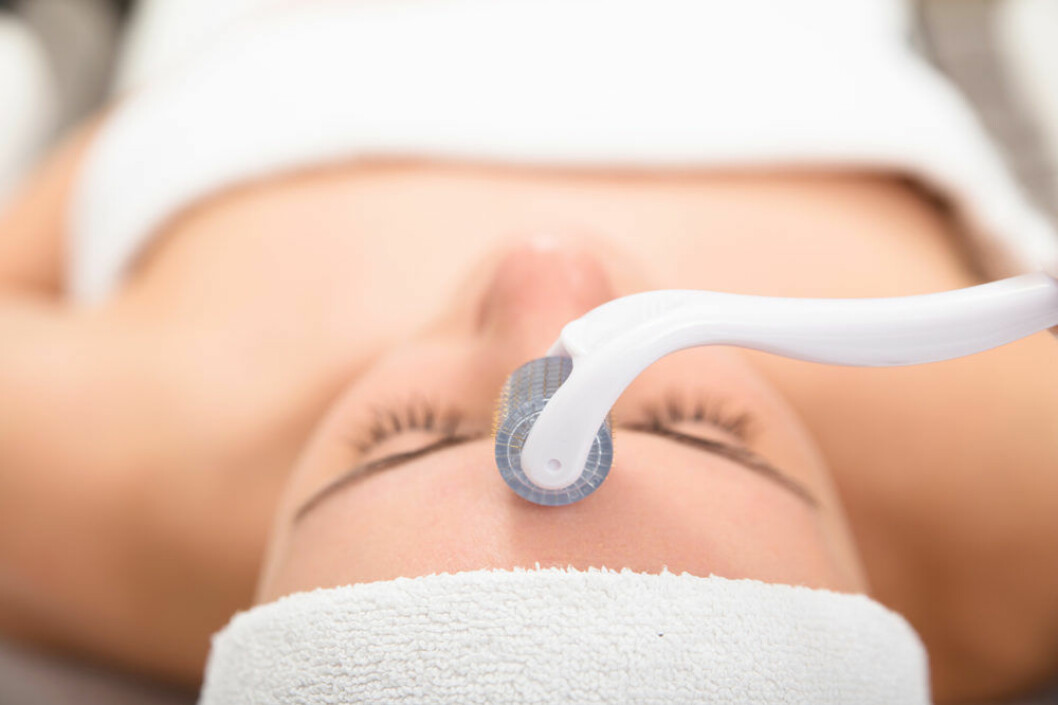 Att behandla huden med en så kallad skin roller gjordes förr bara på salong. Numera finns det rollers framtagna för hemmabruk. Foto: IBL Hudroller även kallad microneedling